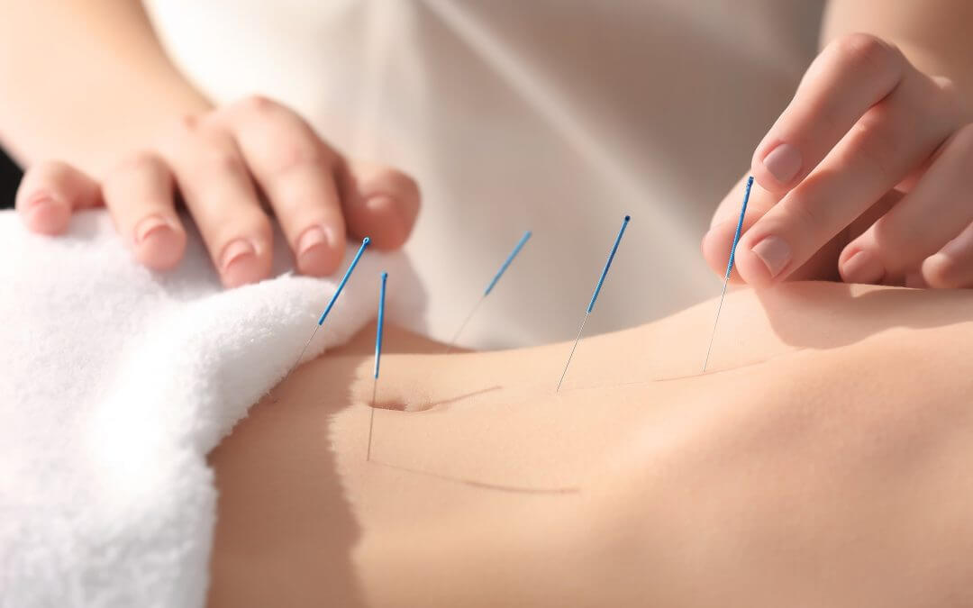 Acupuncture For Lower Back Pain Treatment