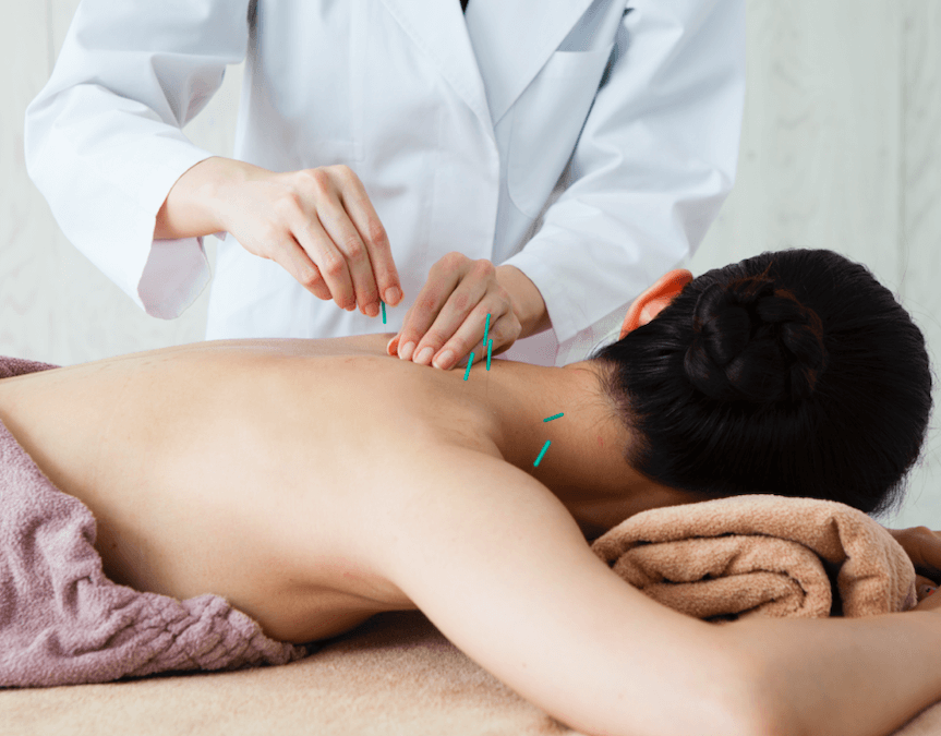 A Closer Look at Acupuncture