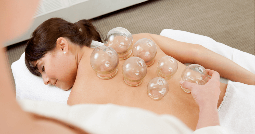 Rediscovering Wellness: Unpacking the Science and Benefits of Cupping Therapy