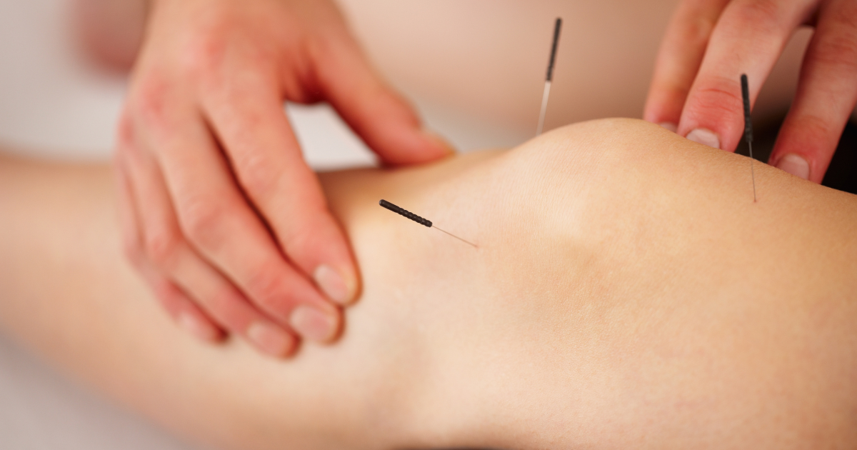 Acupuncture on the knee